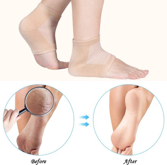 Professor Q Hielsokken met gelpad – huidskleur – 1 paar - detailfoto 2